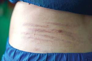 red marks