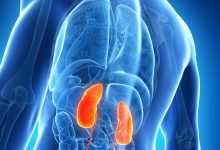ChronicKidneyDisease