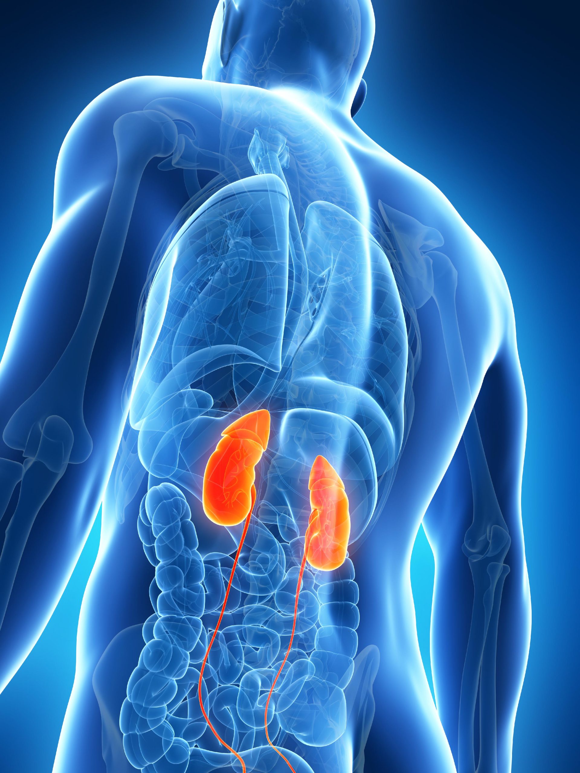 ChronicKidneyDisease scaled